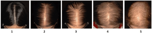 The Clinically proven Protein Supplement that grows your Hair, FASTER and STRONGER.
